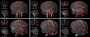 library:gallery1_cerebralcirculation.png