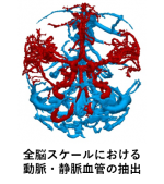 全脳スケールでの動脈・静脈血管の抽出